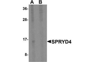 Western blot analysis of SPRYD4 in mouse kidney tissue lysate with SPRYD4 antibody at 1 μg/ml in (A) the absence and (B) the presence of blocking peptide. (SPRYD4 Antikörper  (Center))