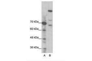 Image no. 1 for anti-Zinc Finger Protein GLI1 (GLI1) (N-Term) antibody (ABIN202973) (GLI1 Antikörper  (N-Term))