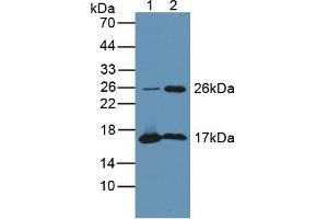 Figure. (Tppp Antikörper  (AA 8-210))
