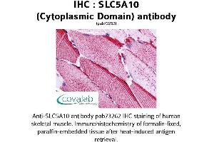 Image no. 1 for anti-Solute Carrier Family 5 (Sodium/glucose Cotransporter), Member 10 (SLC5A10) (Cytoplasmic Domain) antibody (ABIN1739393) (SLC5A10 Antikörper  (Cytoplasmic Domain))