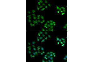 Immunofluorescence analysis of HeLa cells using NSFL1C antibody (ABIN5974024). (NSFL1C Antikörper)
