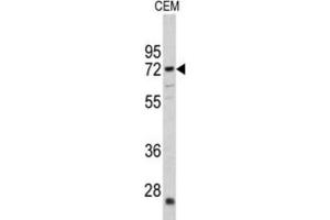 Western Blotting (WB) image for anti-Carnitine O-Acetyltransferase (CRAT) antibody (ABIN3002687) (CRAT Antikörper)