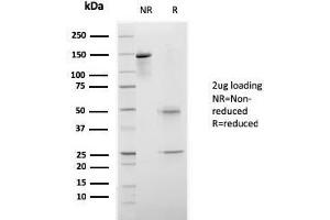 SDS-PAGE Analysis Purified CELA3B Recombinant Mouse Monoclonal Antibody (rCELA3B/1811). (Rekombinanter Elastase 3B Antikörper  (AA 82-238))