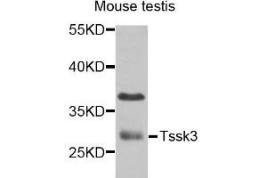 Western blot analysis of extracts of mouse testis cells, using TSSK3 antibody. (TSSK3 Antikörper)