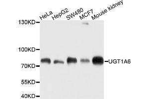 Western blot analysis of extracts of various cells, using UGT1A6 antibody. (UGT1A6 Antikörper)