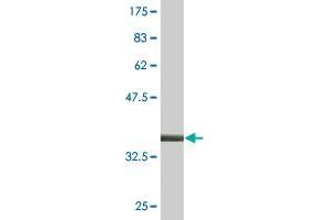 Western Blotting (WB) image for anti-RAB1B, Member RAS Oncogene Family (RAB1B) (AA 91-201) antibody (ABIN529415)