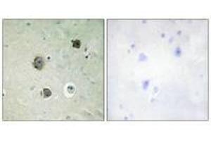 Immunohistochemistry analysis of paraffin-embedded human brain tissue using CDK5 (Ab-15) antibody. (CDK5 Antikörper  (Tyr15))