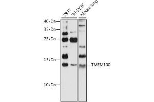 Western blot analysis of extracts of various cell lines, using TMEM100 antibody (ABIN7270950) at 1:1000 dilution. (TMEM100 Antikörper  (C-Term))