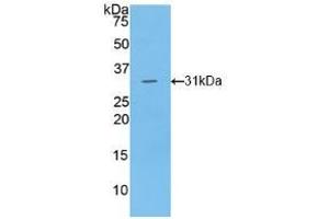 Detection of Recombinant LIPG, Human using Polyclonal Antibody to Lipase, Endothelial (LIPG) (LIPG Antikörper  (AA 175-412))