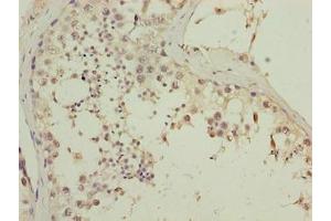 Immunohistochemistry of paraffin-embedded human testis tissue using ABIN7147501 at dilution of 1:100 (CGGBP1 Antikörper  (AA 1-167))