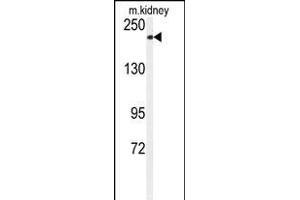 Western blot analysis of anti-CHAK1 Antibody (C-term) (ABIN392614 and ABIN2837991) in mouse kidney tissue lysates (35 μg/lane). (TRPM7 Antikörper  (C-Term))
