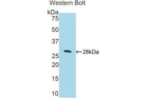 Western blot analysis of the recombinant protein. (CTSC Antikörper  (AA 231-462))