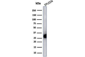 Western Blot Analysis of Human Spleen cell lysate using HLA-Pan Mouse Monoclonal Antibody (CR3/43). (MHC Class II HLA-DP/DQ/DR Antikörper)