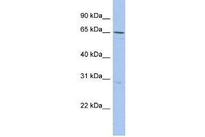 WB Suggested Anti-DQX1 Antibody Titration:  0. (DQX1 Antikörper  (N-Term))