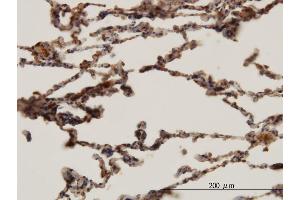 Immunoperoxidase of monoclonal antibody to HBB on formalin-fixed paraffin-embedded human lung.