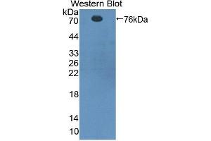 Western blot analysis of recombinant Rat CTTN. (Cortactin Antikörper  (AA 1-509))