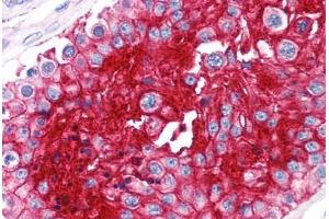 Human Testis (formalin-fixed, paraffin-embedded) stained with BSG antibody ABIN239812 at 10 ug/ml followed by biotinylated anti-mouse IgG secondary antibody ABIN481714, alkaline phosphatase-streptavidin and chromogen. (CD147 Antikörper)