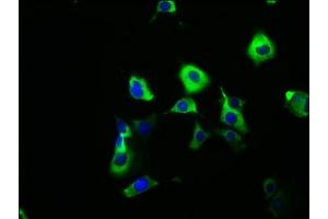 Immunofluorescence staining of MCF-7 cells with ABIN7171161 at 1:166, counter-stained with DAPI.