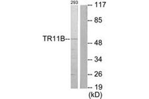 Western Blotting (WB) image for anti-Tumor Necrosis Factor Receptor Superfamily, Member 11b (TNFRSF11B) (AA 10-59) antibody (ABIN2889302) (Osteoprotegerin Antikörper  (AA 10-59))