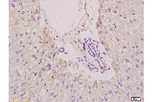 Formalin-fixed and paraffin embedded mouse liver tissue labeled with Anti EPHX2 Polyclonal Antibody,Unconjugated (ABIN750553) at 1:200 followed by conjugation to the secondary antibody and DAB staining. (EPHX2 Antikörper  (AA 351-450))