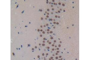 IHC-P analysis of Kidney tissue, with DAB staining. (FOXP1 Antikörper  (AA 122-346))
