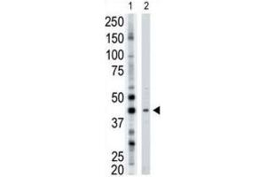 Western Blotting (WB) image for anti-ADP-Ribosyltransferase 3 (ART3) antibody (ABIN3001504) (ART3 Antikörper)