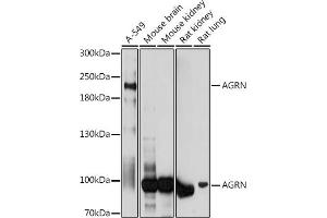 Western blot analysis of extracts of various cell lines, using AGRN antibody (ABIN7265516) at 1:1000 dilution. (AGRN Antikörper  (AA 30-350))