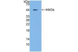 Western blot analysis of recombinant Human KRT7. (Cytokeratin 7 Antikörper  (AA 91-394))