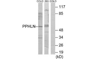 Western Blotting (WB) image for anti-Periphilin 1 (PPHLN1) (Internal Region) antibody (ABIN1849790) (PPHLN1 Antikörper  (Internal Region))