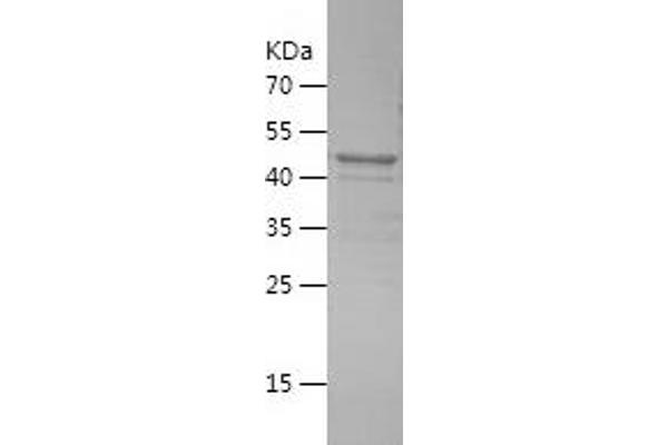 COLEC11 Protein (AA 47-271) (His-IF2DI Tag)