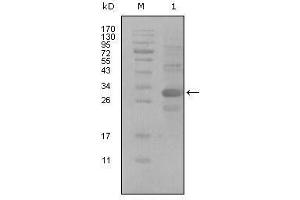 Western Blot showing ALCAM antibody used against truncated Trx-ALCAM recombinant protein (1). (CD166 Antikörper  (AA 405-524))