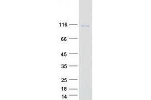Western Blotting (WB) image for Vacuolar Protein Sorting 41 Homolog (VPS41) (Transcript Variant 1) protein (Myc-DYKDDDDK Tag) (ABIN2735429)