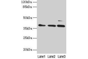 Western blot All lanes: MRPL3 antibody at 6 μg/mL Lane 1: Hela whole cell lysate Lane 2: HepG2 whole cell lysate Lane 3: A549 whole cell lysate Secondary Goat polyclonal to rabbit IgG at 1/10000 dilution Predicted band size: 39 kDa Observed band size: 39 kDa (MRPL3 Antikörper  (AA 201-348))