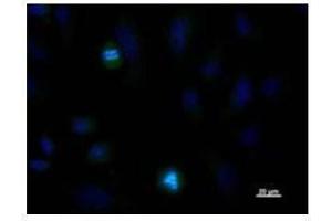 Immunostaining analysis in HeLa cells. (NDC80 Antikörper)