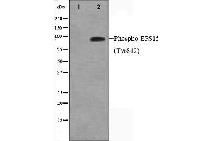 Western blot analysis on HepG2 cell lysate using Phospho-EPS15(Tyr849) Antibody,The lane on the left is treated with the antigen-specific peptide. (EPS15 Antikörper  (pTyr849))
