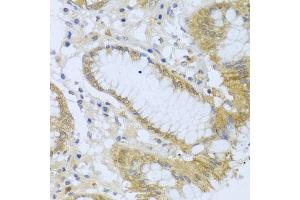 Immunohistochemistry of paraffin-embedded human stomach using  antibody (ABIN6127321, ABIN6136446, ABIN6136448 and ABIN6216005) at dilution of 1:100 (40x lens). (ACP1 Antikörper  (AA 1-158))