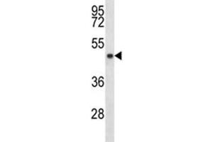 SIRT3 antibody western blot analysis in MDA-MB453 lysate. (SIRT3 Antikörper  (AA 56-84))