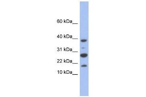 NDUFC1 antibody used at 1 ug/ml to detect target protein. (NDUFC1 Antikörper)