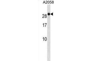 Western Blotting (WB) image for anti-RAB7B, Member RAS Oncogene Family (RAB7B) antibody (ABIN3001226) (RAB7B Antikörper)