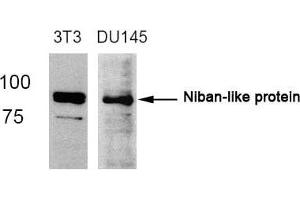 Western blot analysis of extracts from 3T3 and DU145 cells using Niban-like protein(Ab-712) antibody. (MEG3 Antikörper)