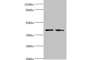 Western blot All lanes: LGALS9 antibody at 14 μg/mL Lane 1: Hela whole cell lysate Lane 2: Jurkat whole cell lysate Secondary Goat polyclonal to rabbit IgG at 1/10000 dilution Predicted band size: 40, 36, 35, 27, 26, 39 kDa Observed band size: 40 kDa