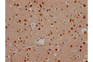 IHC image of ABIN7127644 diluted at 1:100 and staining in paraffin-embedded human brain tissue performed on a Leica BondTM system. (Rekombinanter Notch1 Antikörper)