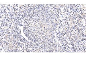Detection of CD73 in Human Tonsil Tissue using Polyclonal Antibody to Cluster Of Differentiation 73 (CD73) (CD73 Antikörper  (AA 29-500))