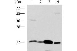 Western blot analysis of Mouse Pancreas tissue Mouse small intestines tissue Mouse large intestine tissue Human sigmoid tissue lysates using ZG16 Polyclonal Antibody at dilution of 1:1350 (ZG16 Antikörper)
