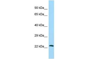 Host: Rabbit Target Name: ATG10 Sample Type: HepG2 Whole Cell lysates Antibody Dilution: 1. (ATG10 Antikörper  (C-Term))