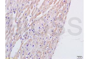 Formalin-fixed and paraffin embedded rat heart tissue labeled with Anti-PTAFR Polyclonal Antibody, Unconjugated (ABIN687127) at 1:200 followed by conjugation to the secondary antibody and DAB staining (PTAFR Antikörper  (AA 231-342))