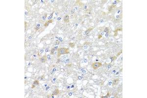 Immunohistochemistry of paraffin-embedded rat brain using INPP5K antibody at dilution of 1:100 (x40 lens). (INPP5K Antikörper)