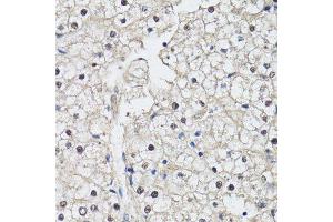 Immunohistochemistry of paraffin-embedded human liver using CDK7 antibody. (CDK7 Antikörper  (AA 211-346))