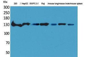 Western Blotting (WB) image for anti-Interleukin 16 (IL16) (C-Term) antibody (ABIN3178206) (IL16 Antikörper  (C-Term))