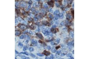 Immunohistochemical analysis of CD122 staining in human lymph node formalin fixed paraffin embedded tissue section. (IL2 Receptor beta Antikörper)